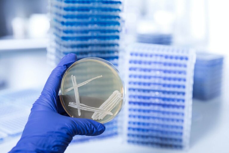 Hand in blue glove holding a petri dish with a Pichia pastoris yeast culture in a biotechnology laboratory, VALIDOGEN