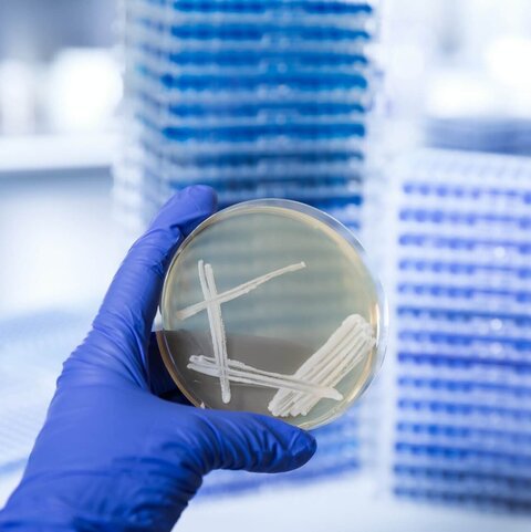 Hand in blue glove holding a petri dish with a Pichia pastoris yeast culture in a biotechnology laboratory, VALIDOGEN